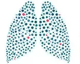 Treatment for Mesothelioma Veteran-specific help and information is available."